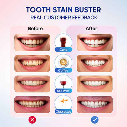 NovaSmile™ Niacinamide Whitening Toothpaste